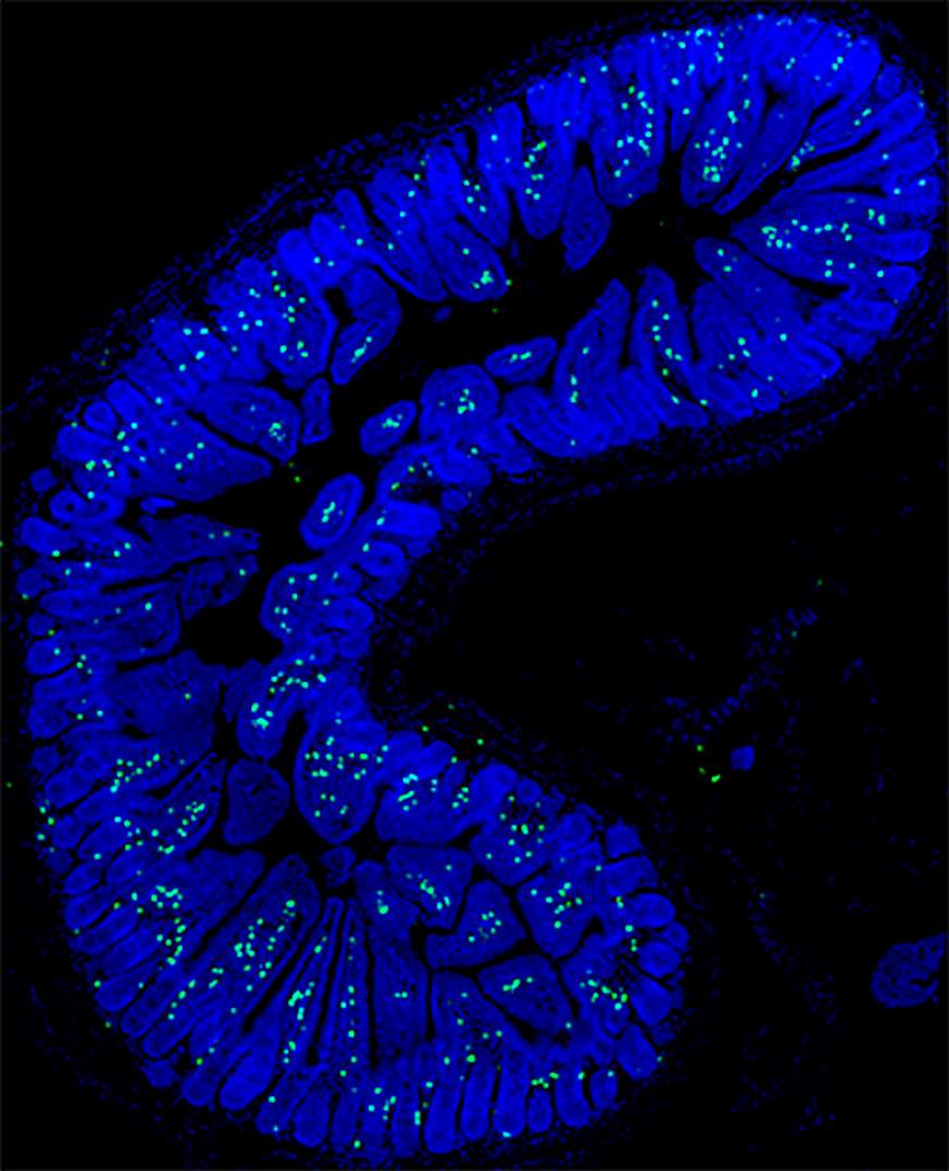 a small intestine.