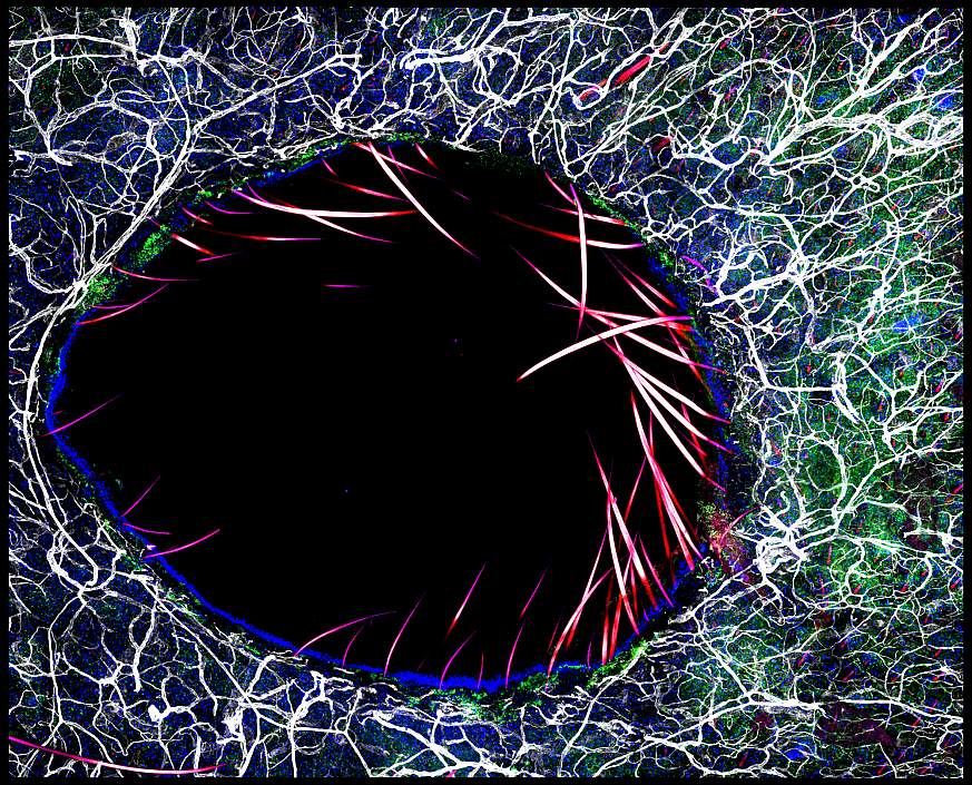 Immunofluorescent image of immune cells surrounding a skin wound