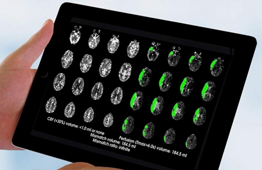 Brain Scans