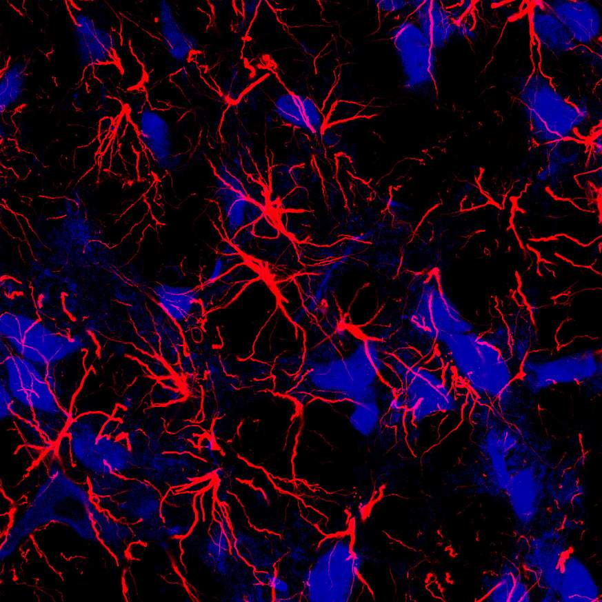 star-shaped brain cells, called astrocytes (red)