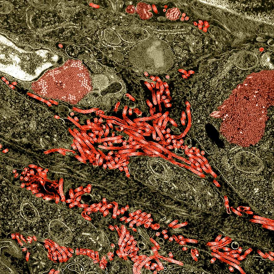 Colorized transmission electron micrograph of the ovary from a nonhuman primate infected with Ebola virus.