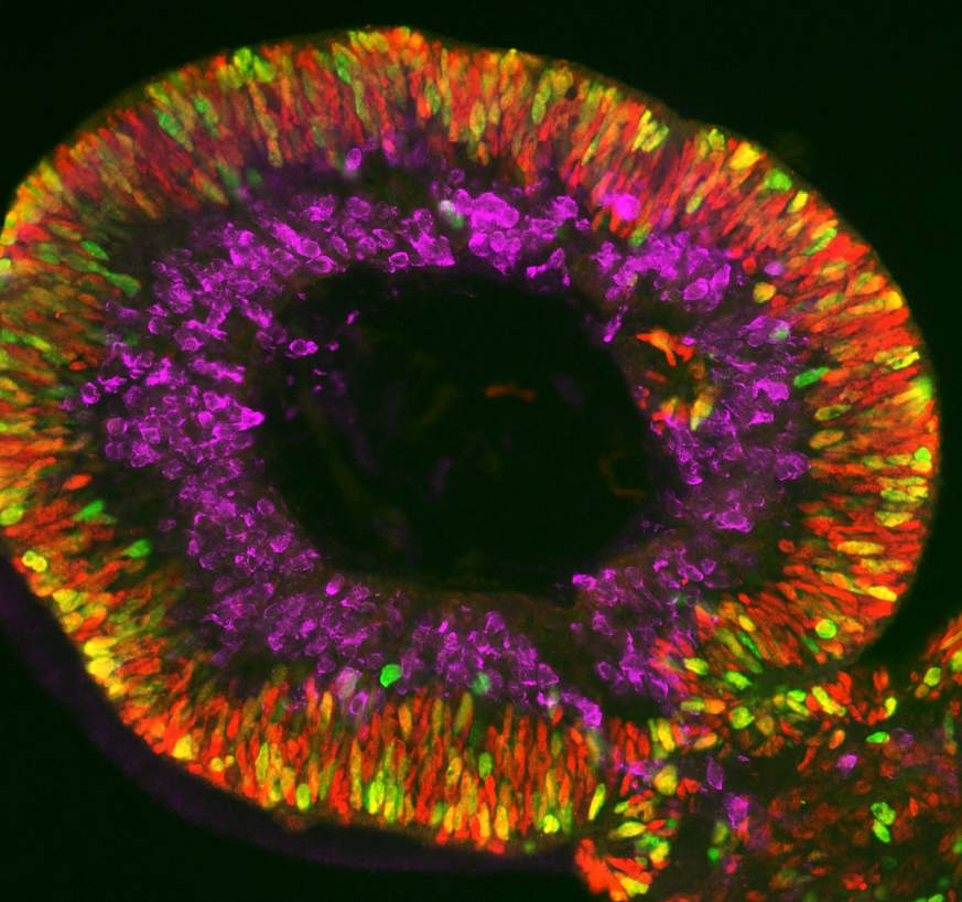 Image of a retina organoid under microscope