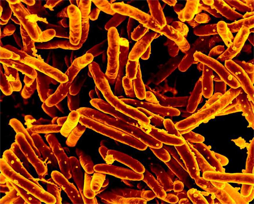 Image of tuberculosis-causing bacteria
