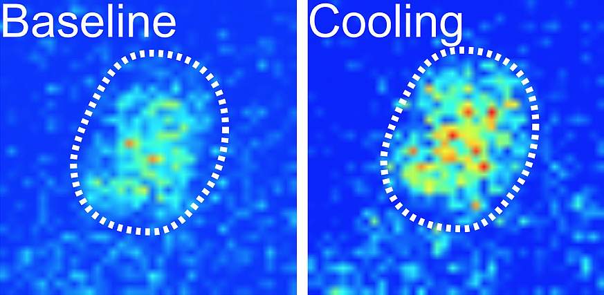 Image showing cooling activity in fly brain
