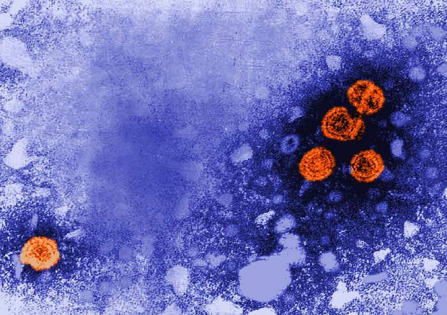 Microscopic image of Hep B virus particles 