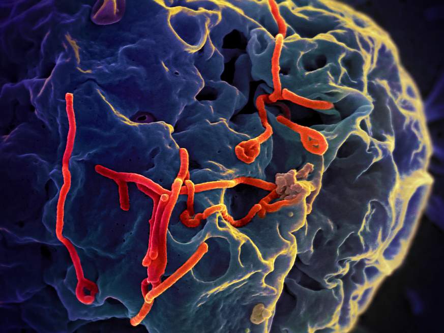Microscopic image for Ebola virus particles.