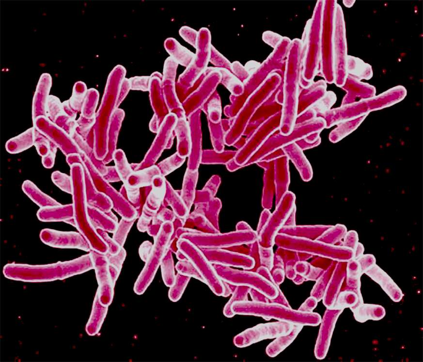 Scanning electron micrograph of Mycobacterium tuberculosis bacteria