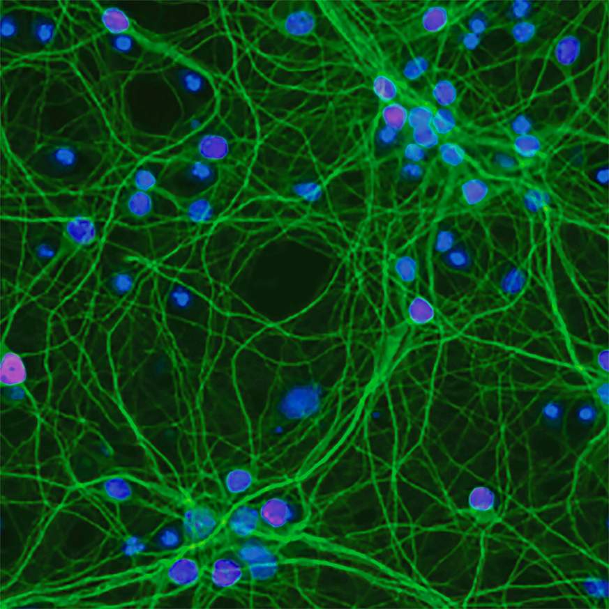 Microscopic image of neurons