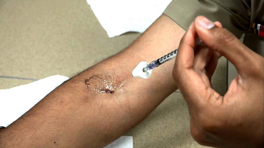 Image of a scientist applying treatment.