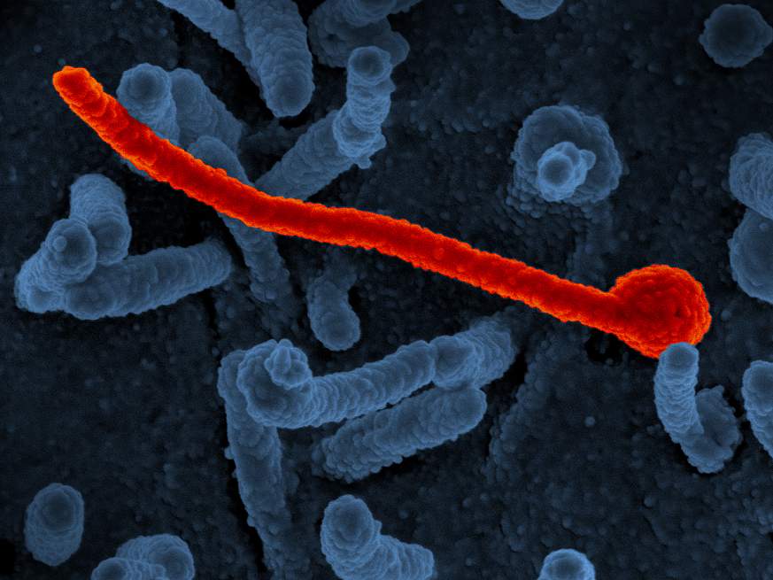 Scanning electron micrograph of Ebola virus Makona (in red) from the West African epidemic shown on surface of Vero cells (blue). 