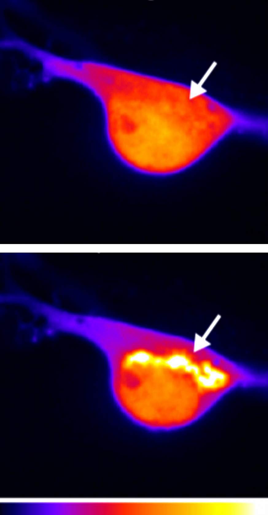 Micrograph of neuronal cell bodies