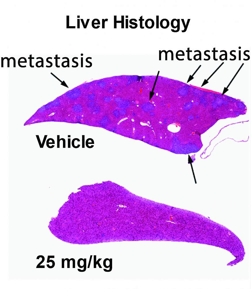 A compound breaks down a component of cancer cells.