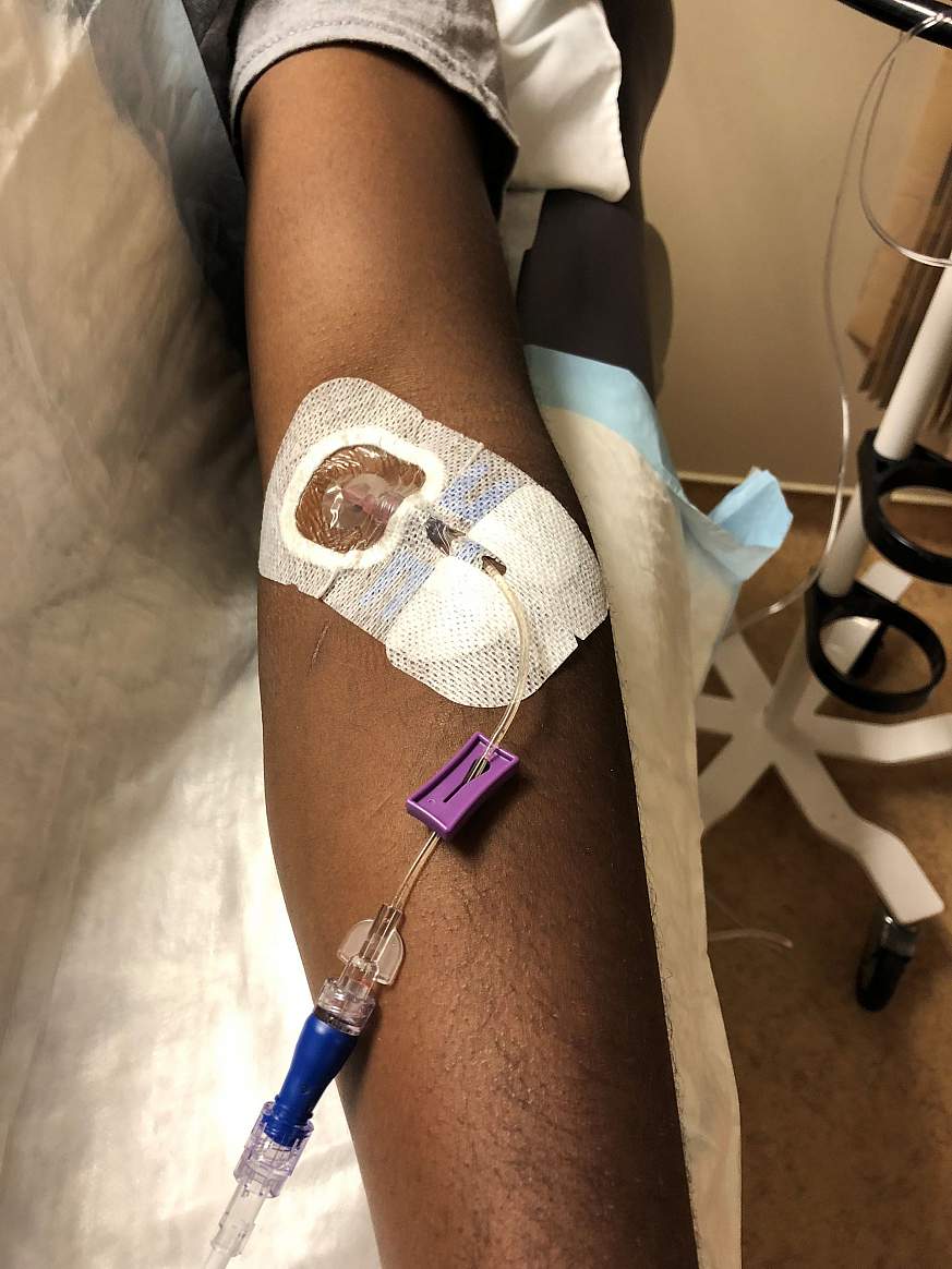 Image of volunteer receiving IV infusion
