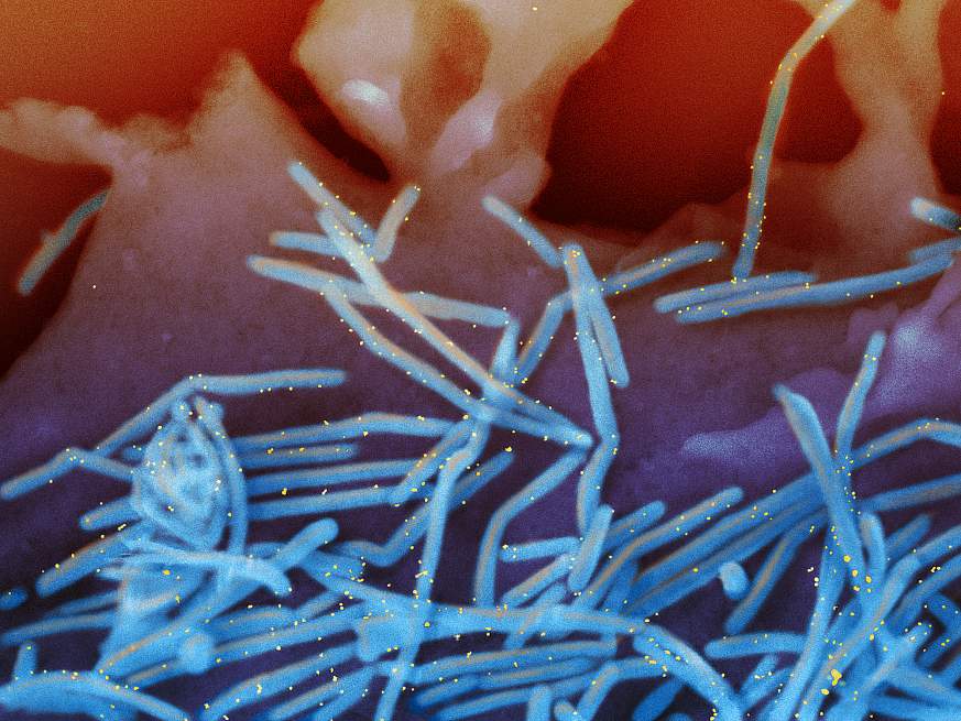 An image of RSV particles, colored blue