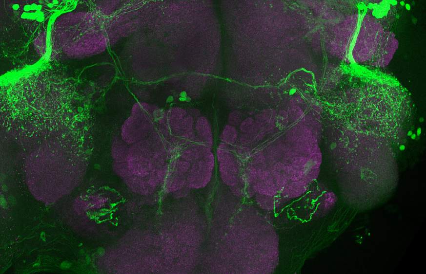 Image of a brain scan of a fruit fly