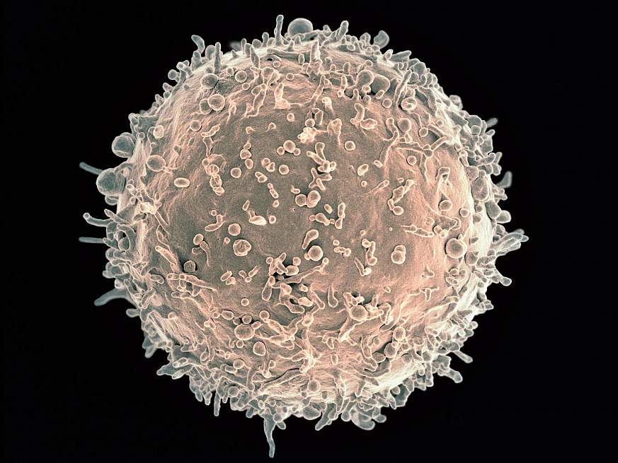 Image of a human B cell