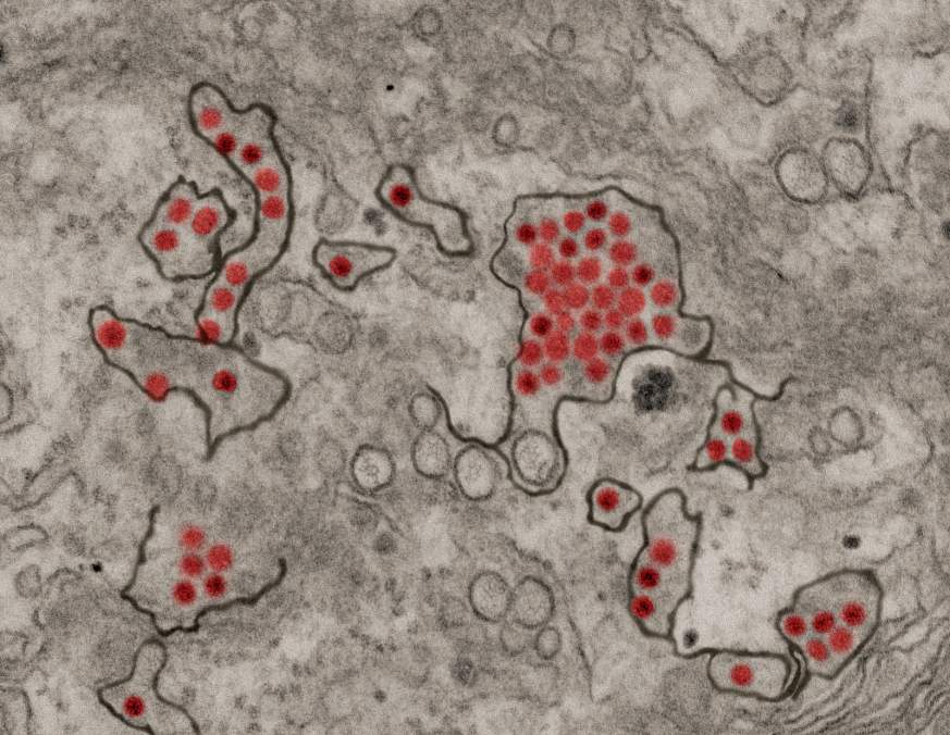 Microscopic image of Zika virus particles
