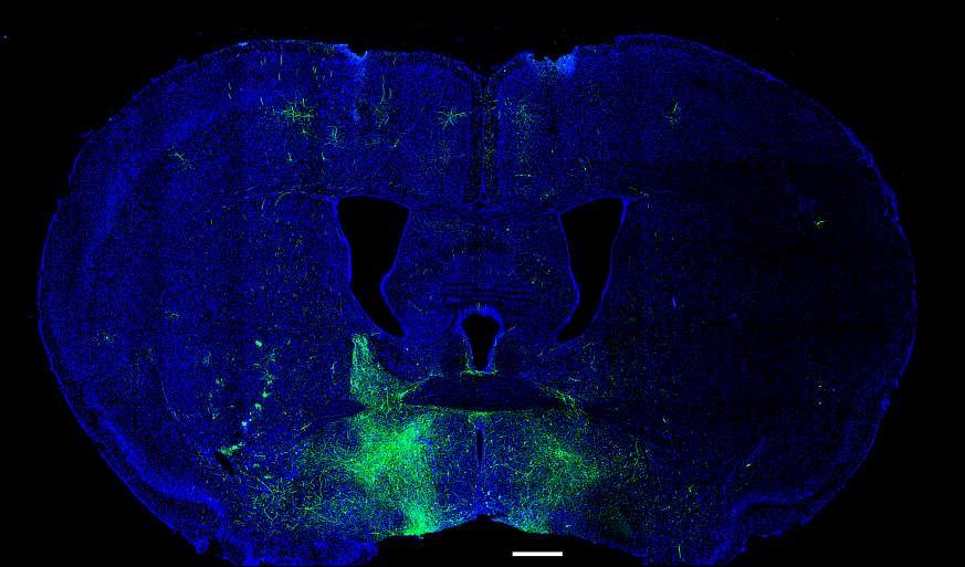 microscopy image of a rodent brain cross-section; pathways in the extended amygdala related to reward-seeking and aversion are labeled in fluorescent green 