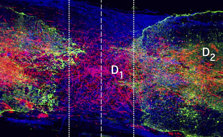 Microscopic scan of axon regrowth