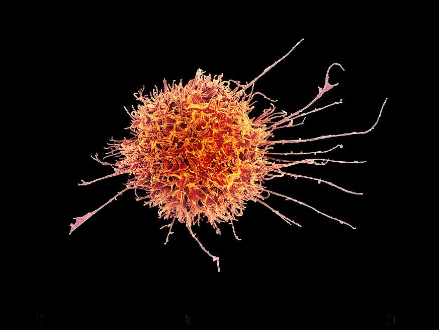 Scanning electron micrograph of a human natural killer cell