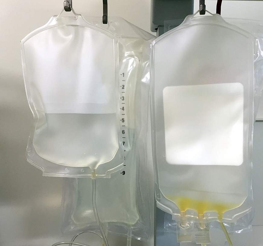 Image of bags of fluid for IV infusions