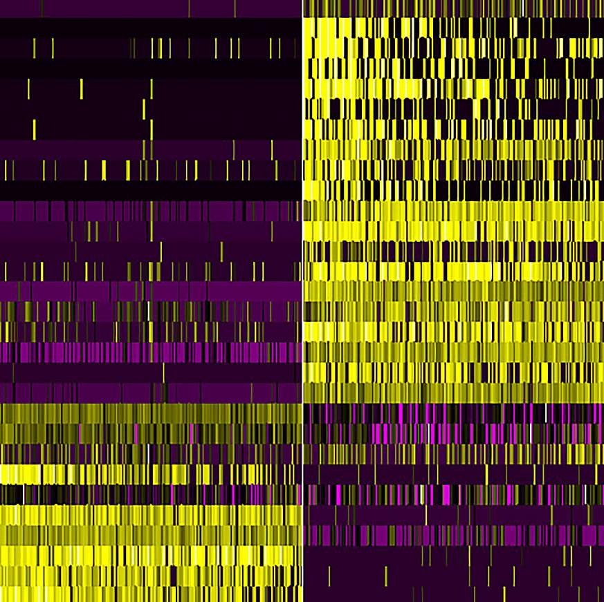 Scan of gene activity in the brain