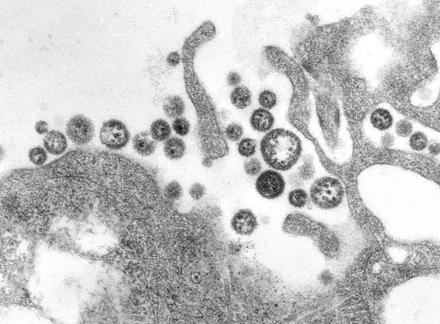 Transmission electron microscopic image of Lassa virus