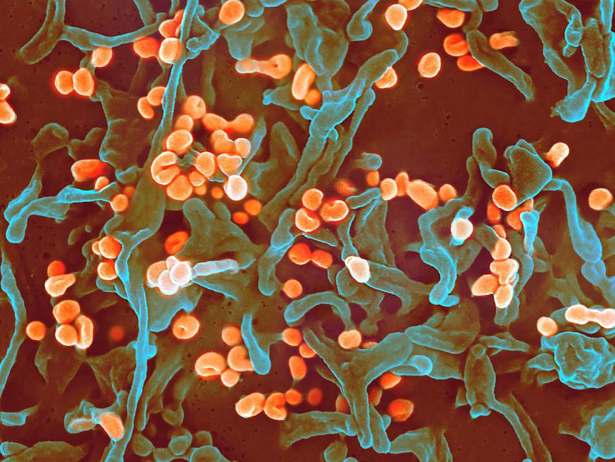Microscopic image of Lassa virus