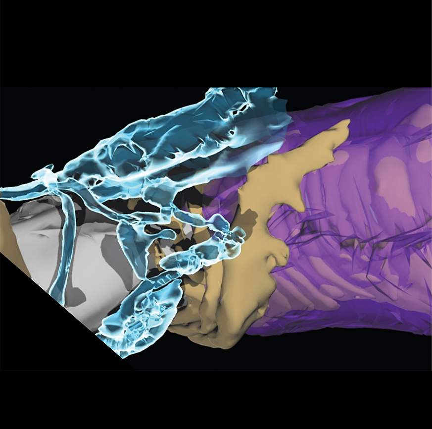 3D illustration of an astrocyte