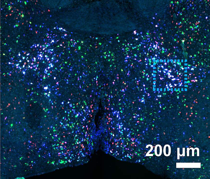 Image of a mouse brain scan