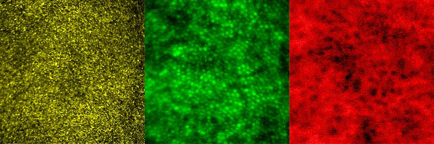 Images show multimodal technique using adaptive optics and angiography to simultaneously see photoreceptors (left), retinal pigment epithelial cells (center), and choriocapillaris in the living human eye. 