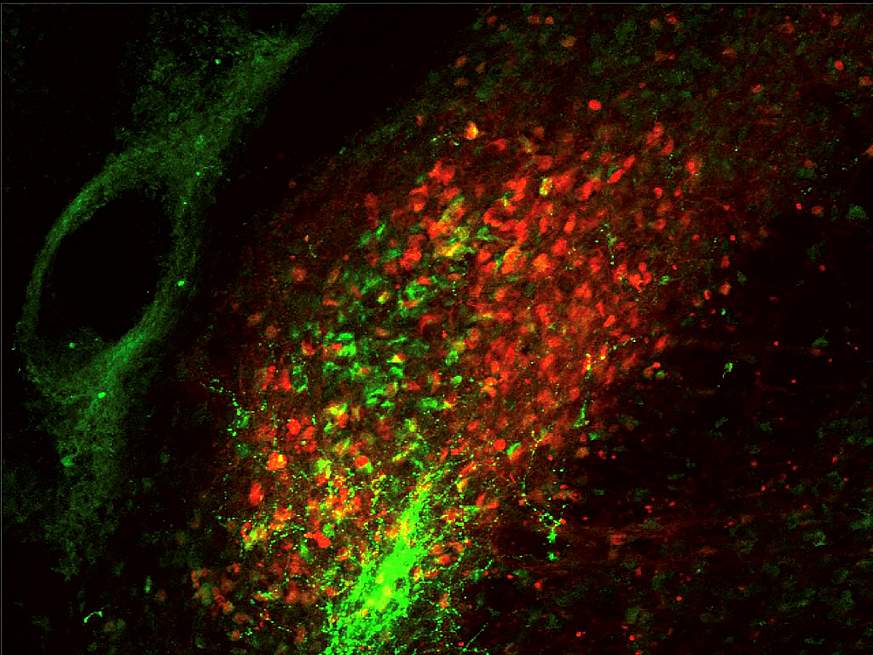 Microscopic scan of parabrachial neurons