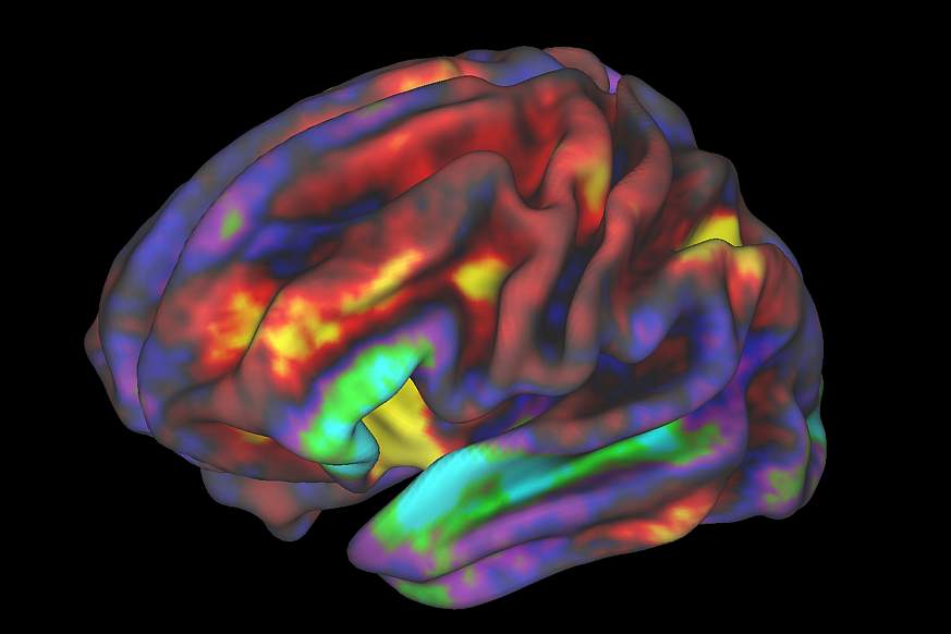 fMRI image of preteen brain.