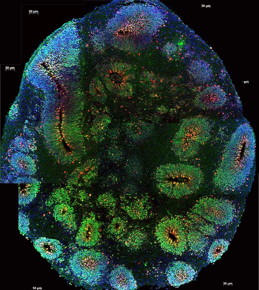 Image of a human cortex organoid