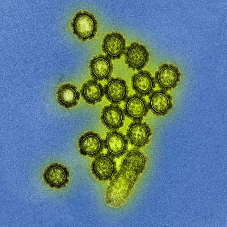 A transmission electron micrograph showing H1N1 influenza virus particles.