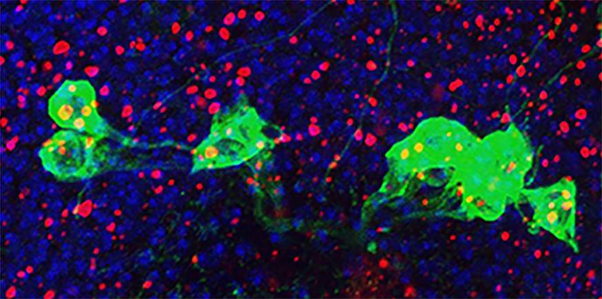 NIH study implicates hyperactive immune system in aging brain disorders ...