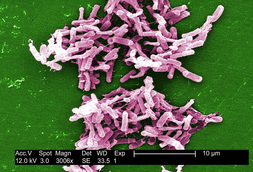 Clostridium difficile bacteria.
