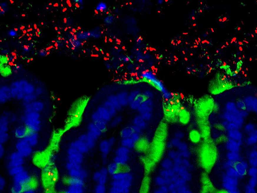 Cells in the mouse small intestine.