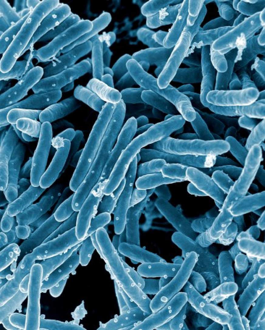 Tuberculosis bacteria.