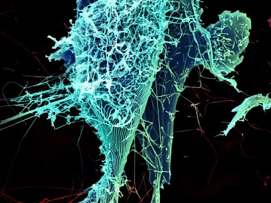 String-like Ebola virus peeling off an infected cell.