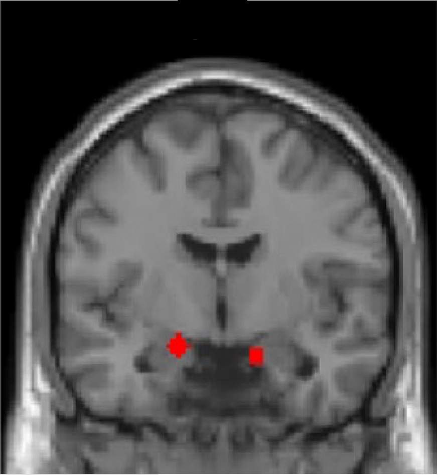 Image of a brain scan