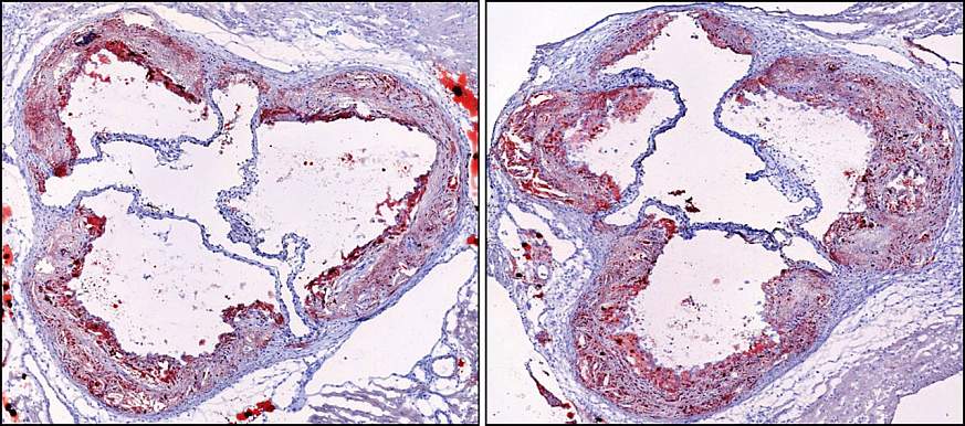 Cross-section images of mouse arteries