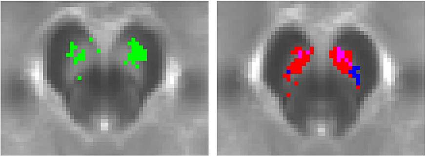 Digital images of NM-MRI brain scans.