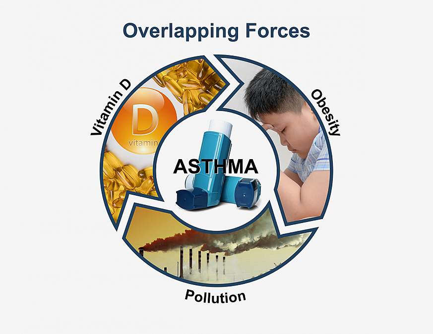 Graphic of the interaction of vitamin D, obesity, and air pollution on asthma