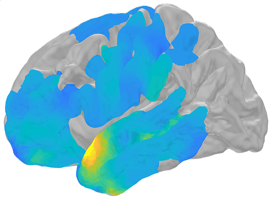 Computer-generated brain scan.