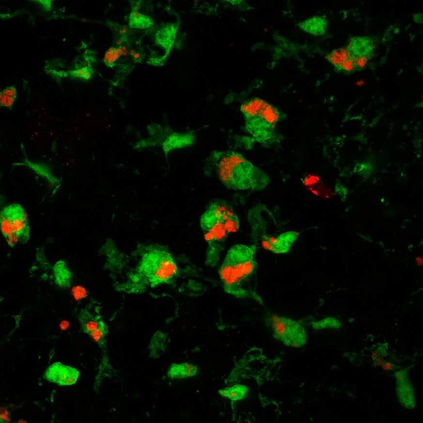 Microscopic image of cells in the retina