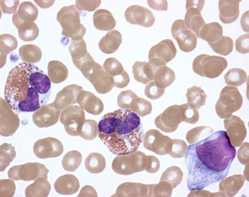 Microscopic image of eosinophils