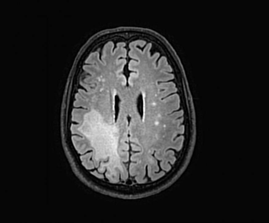 Image of an MRI scan