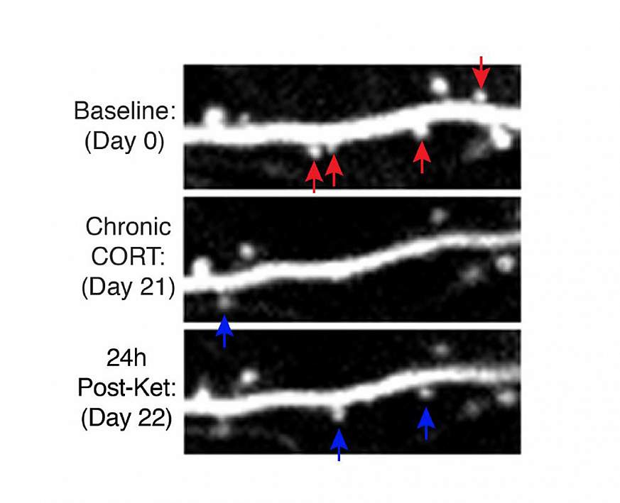 Images of dendritic remodeling