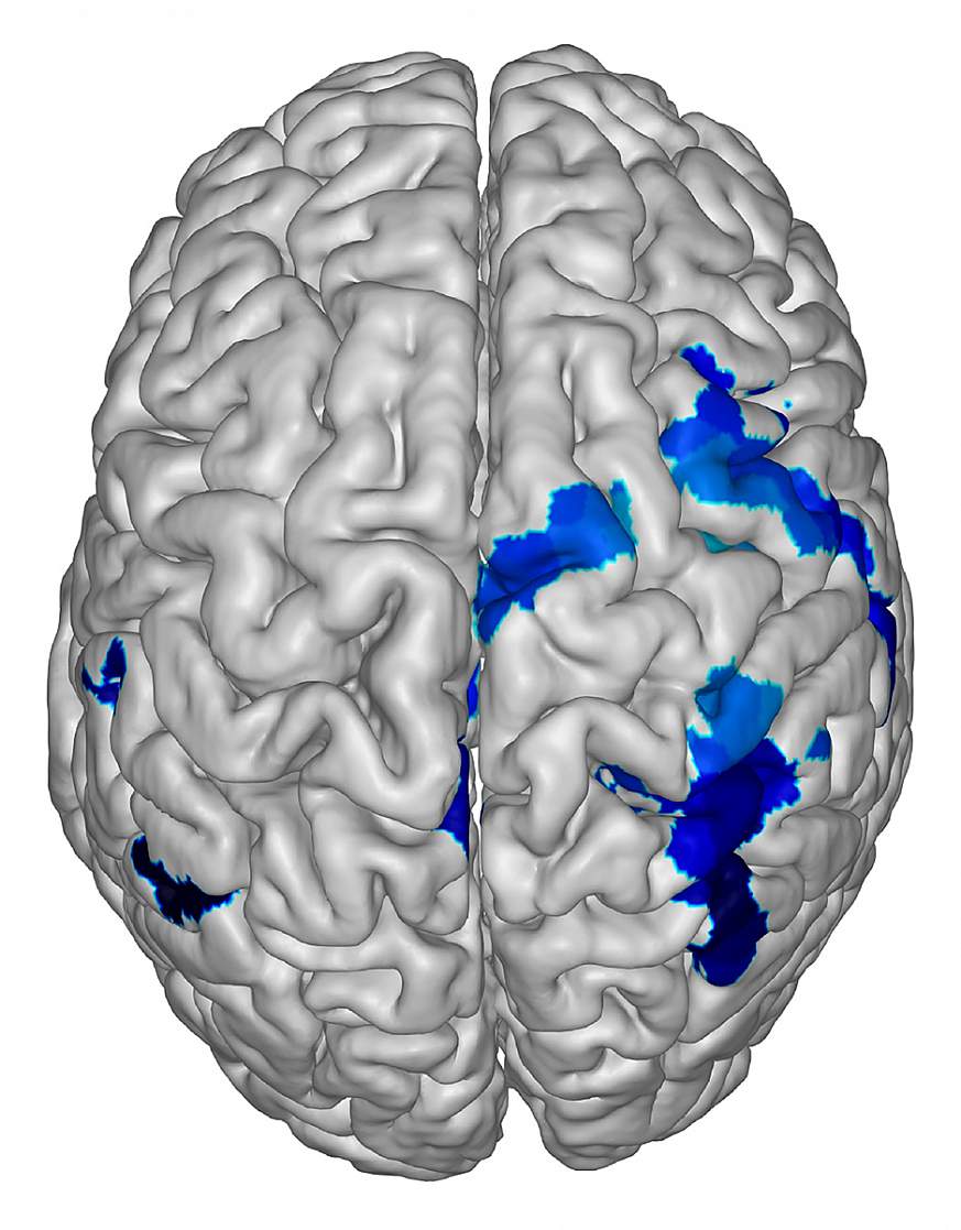 Computer generated image of a human brain.